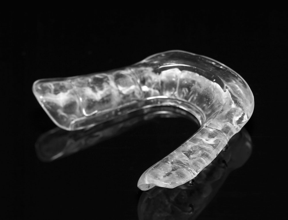 Occlusal hard splint for treatment of TMD