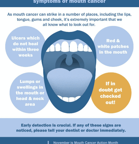 mouth cancer risk factors
