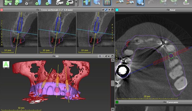 digital dentistry CAD CAM